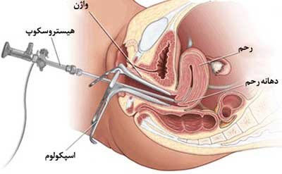 عکس رنگی از رحم درد دارد؟ ، عوارض عکس رنگی رحم، درد عکس رنگی رحم ، عکس رنگی رحم بدون درد ، فیلم عکس رنگی از رحم،  هزینه عکس رنگی از رحم، عکس رنگی رحم و بارداری،  شیاف قبل از عکس رنگی 